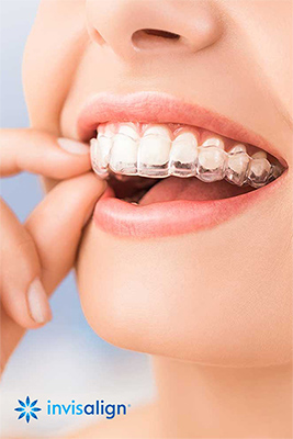 Invisalign